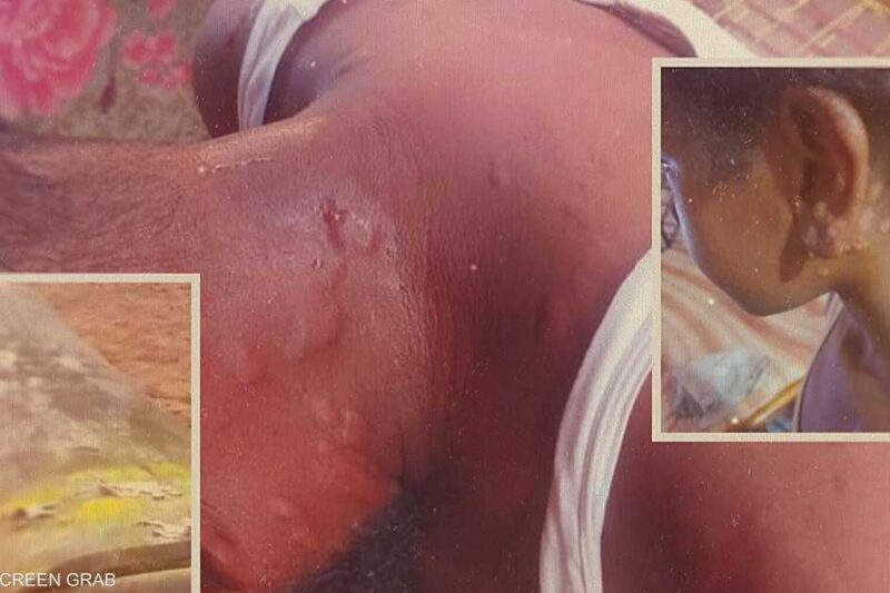 Secret documents fuel allegations that Sudan’s military is producing chemical weapons