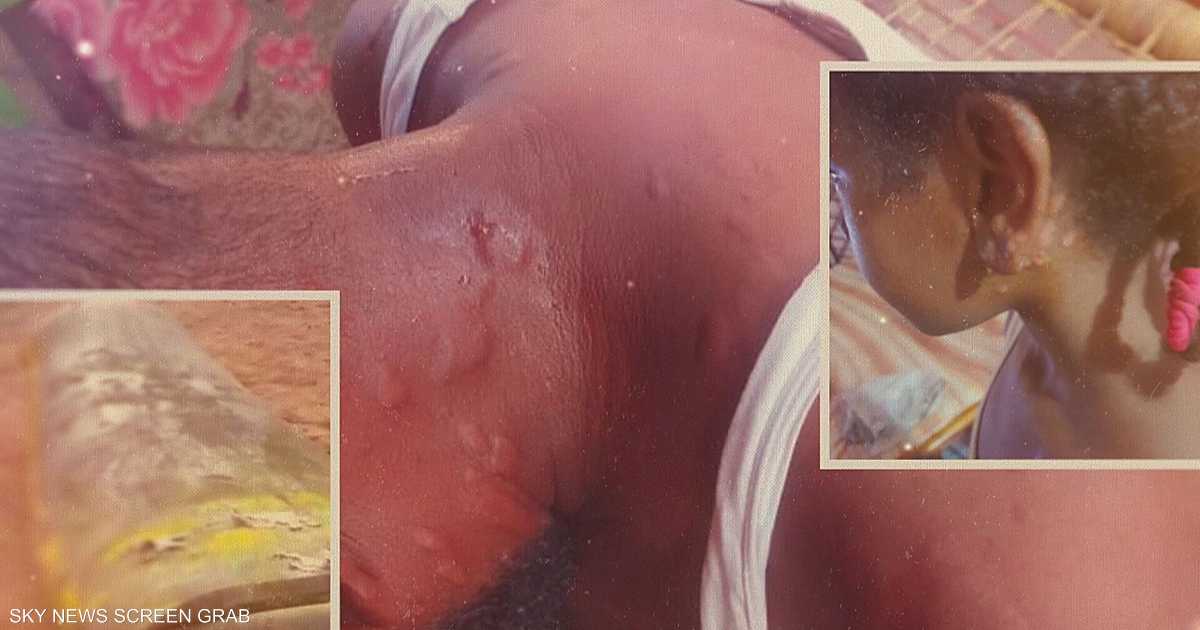 Secret documents fuel allegations that Sudan's military is producing chemical weapons